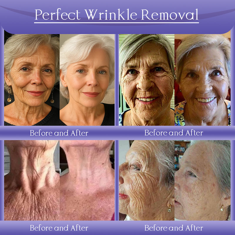 Jorondy® Anti-Wrinkle Skin Cream for Remove Wrinkles, Firms Skin, Whitening - Last Day Sale🔥90% OFF