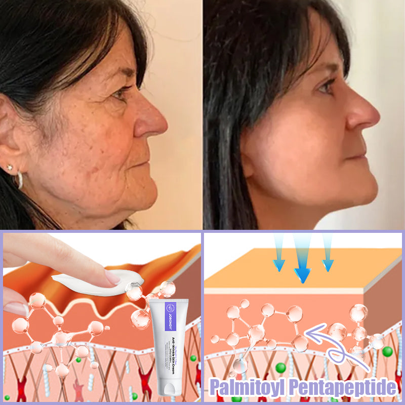Jorondy® Anti-Wrinkle Skin Cream for Remove Wrinkles, Firms Skin, Whitening - Last Day Sale🔥90% OFF