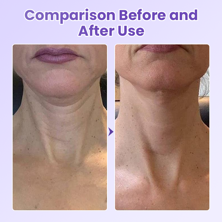 Jorondy® NeckYouth Peptide Anti-Wrinkle Patch