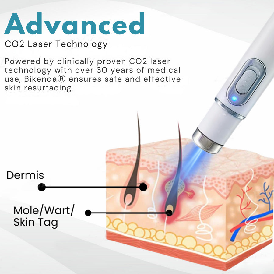 Bikenda® Non-Invasive Mole and Wart Removal Laser Pen 🔥🔥