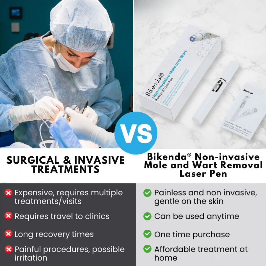 Bikenda® Non-Invasive Mole and Wart Removal Laser Pen 🔥🔥