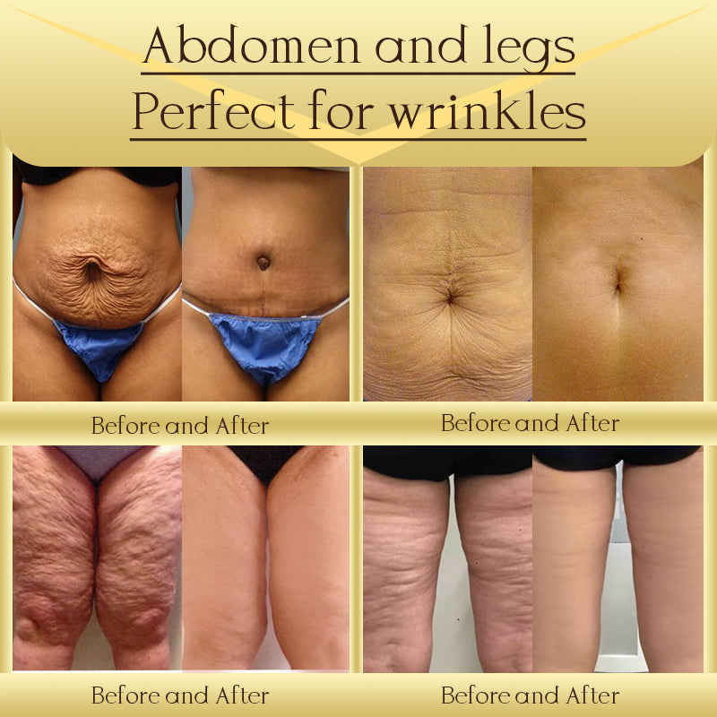 Jorondy® AH-8 Skin Firming Cream -Last Day Sale!🔥90% OFF! 🔥 🔥 🔥