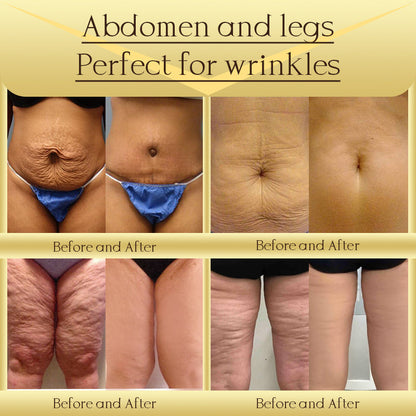 Jorondy® AH-8 Skin Firming Cream -Last Day Sale!🔥90% OFF! 🔥 🔥 🔥