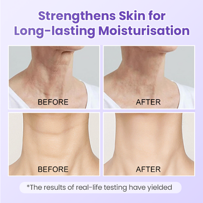 Jorondy® NeckYouth Peptide Anti-Wrinkle Patch