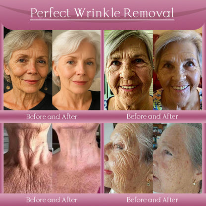 Jorondy® Anti-Wrinkle Skin Cream for Remove Wrinkles, Firms Skin, Whitening - Last Day Sale🔥90% OFF (Copy)