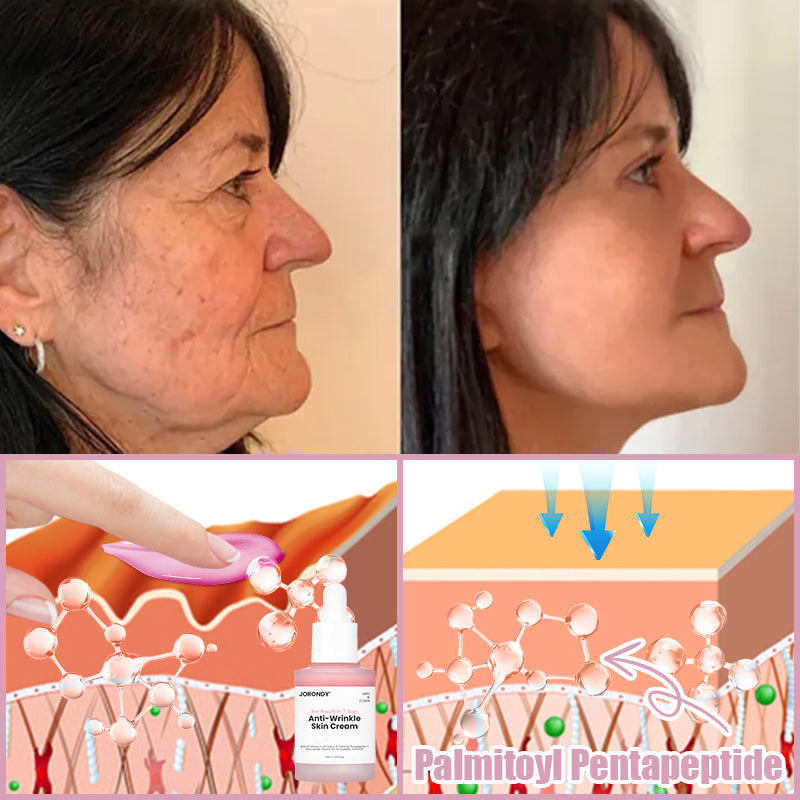 Jorondy® Anti-Wrinkle Skin Cream for Remove Wrinkles, Firms Skin, Whitening - Last Day Sale🔥90% OFF (Copy)