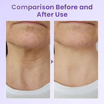 Jorondy® NeckYouth Peptide Anti-Wrinkle Patch