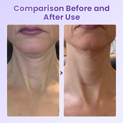 Jorondy® NeckYouth Peptide Anti-Wrinkle Patch