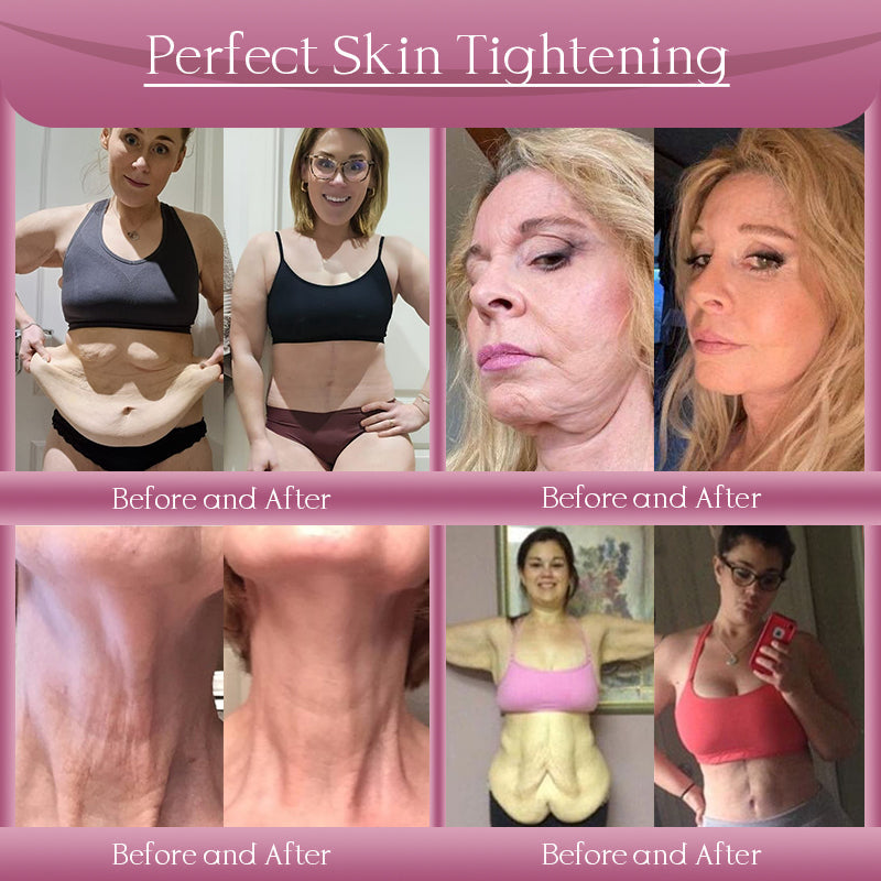 Jorondy® Anti-Wrinkle Skin Cream for Remove Wrinkles, Firms Skin, Whitening - Last Day Sale🔥90% OFF