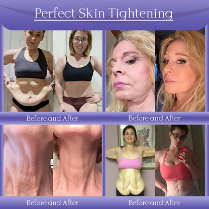 Jorondy® Anti-Wrinkle Skin Cream for Remove Wrinkles, Firms Skin, Whitening - Last Day Sale🔥90% OFF