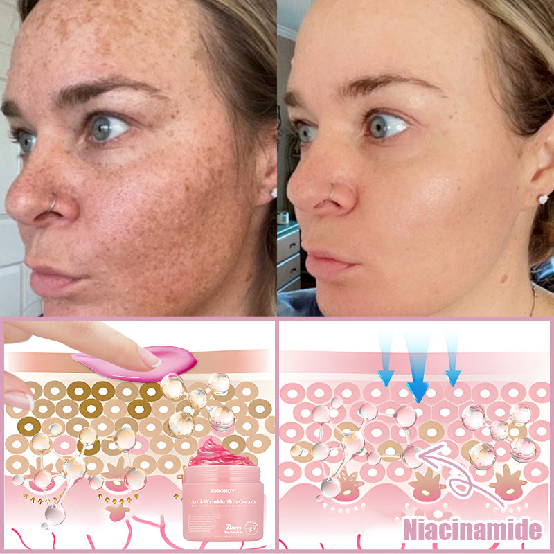 Jorondy® Anti-Wrinkle Skin Cream for Remove Wrinkles, Firms Skin, Whitening - Last Day Sale🔥90% OFF