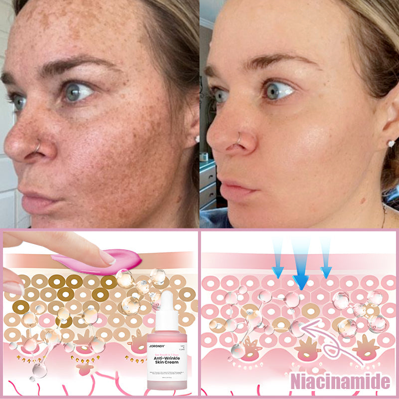 Jorondy® Anti-Wrinkle Skin Cream for Remove Wrinkles, Firms Skin, Whitening - Last Day Sale🔥90% OFF (Copy)