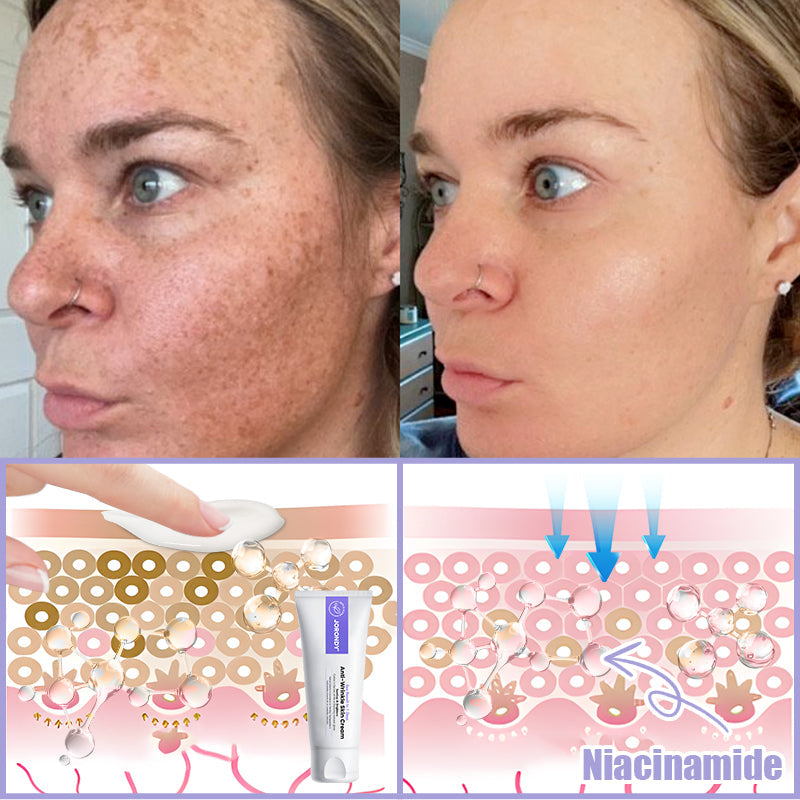 Jorondy® Anti-Wrinkle Skin Cream for Remove Wrinkles, Firms Skin, Whitening - Last Day Sale🔥90% OFF