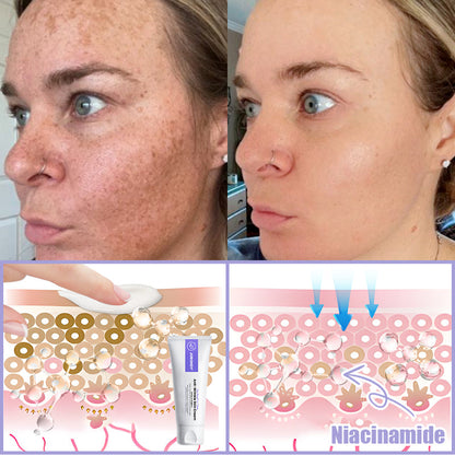 Jorondy® Anti-Wrinkle Skin Cream for Remove Wrinkles, Firms Skin, Whitening - Last Day Sale🔥90% OFF