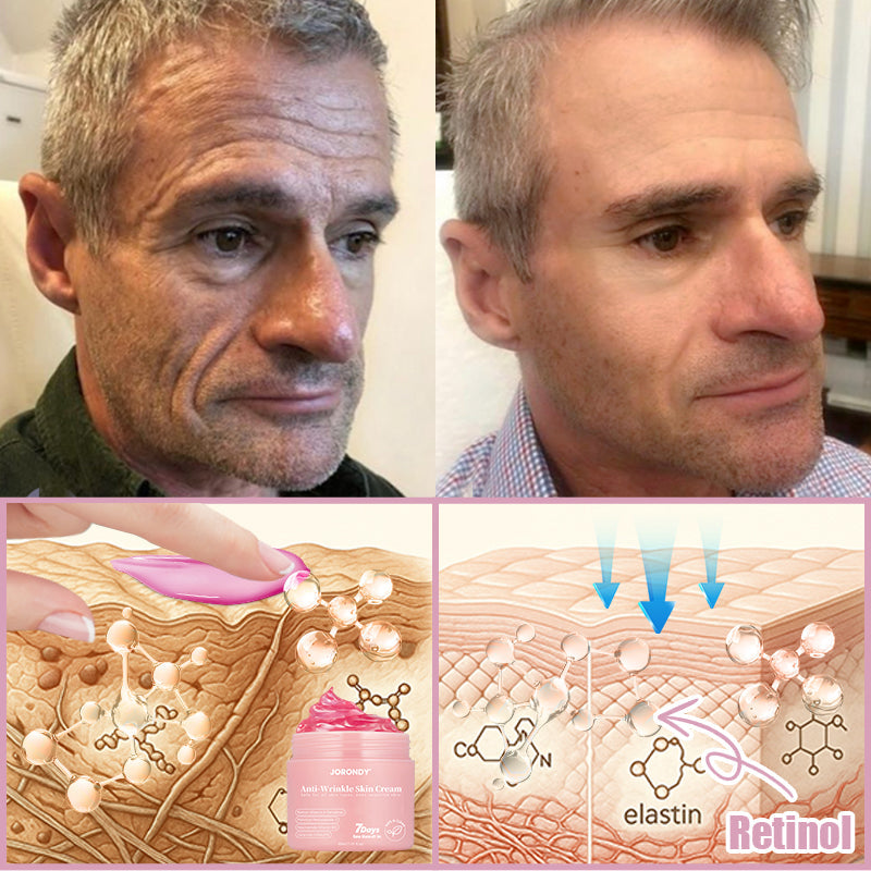 Jorondy® Anti-Wrinkle Skin Cream for Remove Wrinkles, Firms Skin, Whitening - Last Day Sale🔥90% OFF