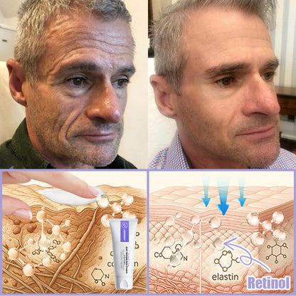 Jorondy® Anti-Wrinkle Skin Cream for Remove Wrinkles, Firms Skin, Whitening - Last Day Sale🔥90% OFF