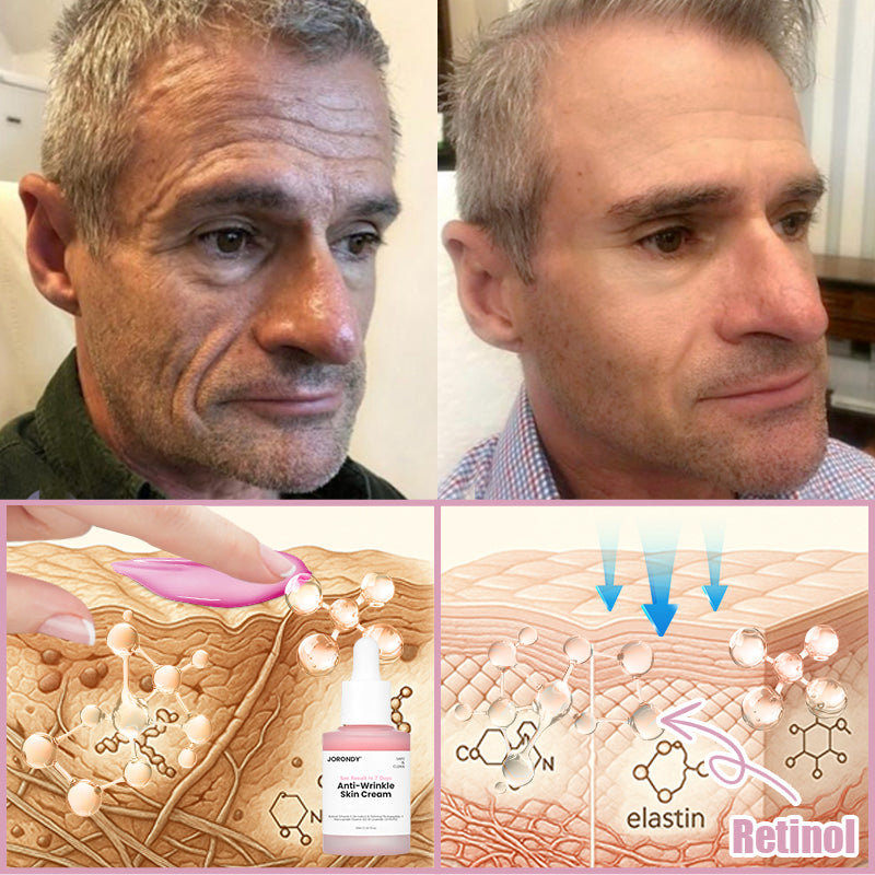 Jorondy® Anti-Wrinkle Skin Cream for Remove Wrinkles, Firms Skin, Whitening - Last Day Sale🔥90% OFF (Copy)