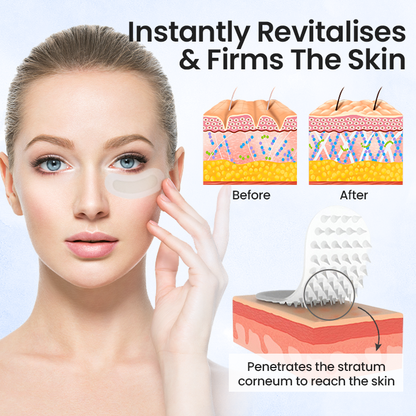 Jorondy® Hyaluronic acid microneedle patch