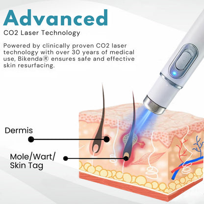 Bikenda® Non-Invasive Mole and Wart Removal Laser Pen 🔥🔥