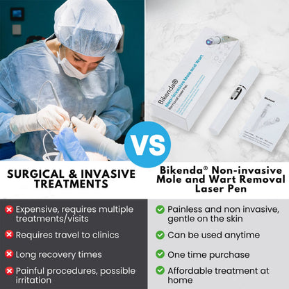 Bikenda® Non-Invasive Mole and Wart Removal Laser Pen 🔥🔥